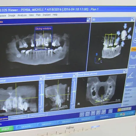 ホテル Serenity ティラナ